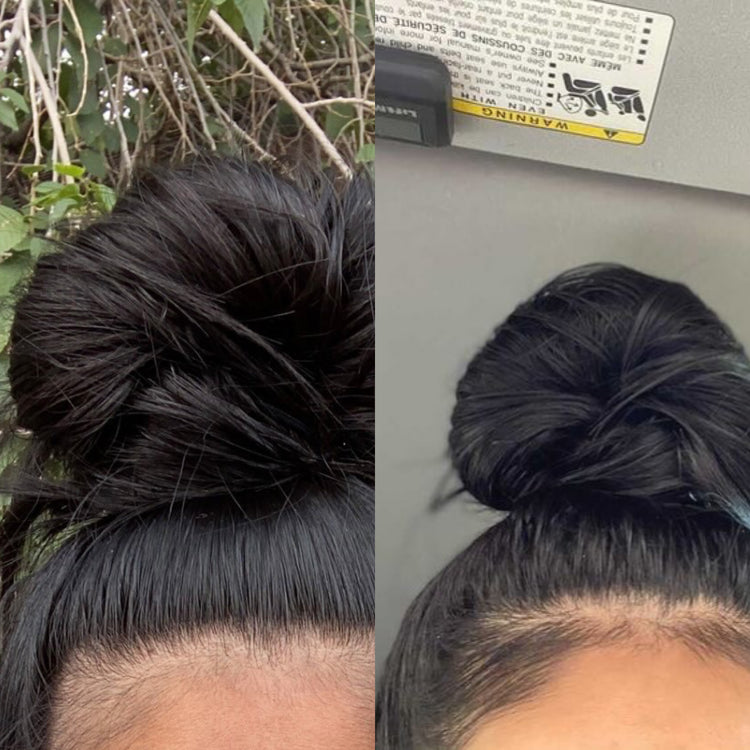Restorative Hair Serum (90-Day Supply)